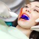 کاربرد لیزر در دندانپزشکی  مزایای ایمپلنت دیجیتال lasser 80x80