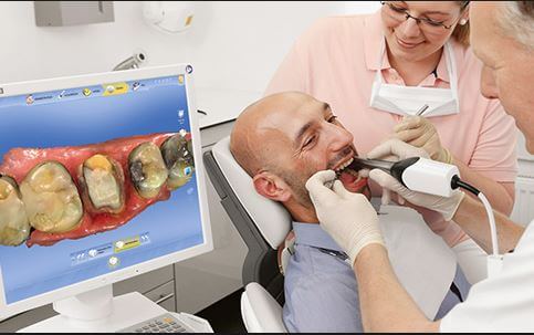 مزایای ایمپلنت دیجیتال scanner intraoral