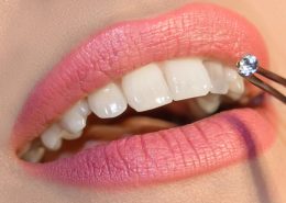 [object object] مراقبت های پس از درمان ریشه tooth gems 260x185  مطالب دندانپزشکی tooth gems 260x185