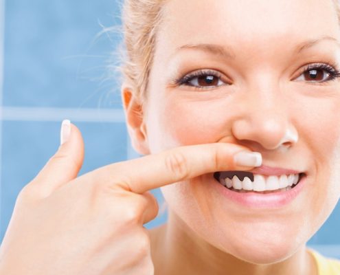 علت سیاه شدن لثه بعد از ایمپلنت  دندانپزشکی بدون درد چگونه است؟ black gum 495x400