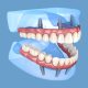 ایمپلنت all on 4 دندانپزشکی آرسته دندانپزشکی آرسته all on 4 dental implants 80x80 دندانپزشکی آرسته دندانپزشکی آرسته all on 4 dental implants 80x80