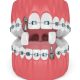 dental implants and orthodontics دندانپزشکی آرسته دندانپزشکی آرسته implants orthodontic 80x80 دندانپزشکی آرسته دندانپزشکی آرسته implants orthodontic 80x80