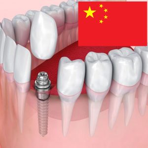 انواع برندهای ایمپلنت Chinese implants 300x300