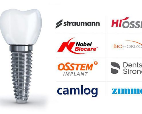 انواع برندهای ایمپلنت dental implant brands 495x398