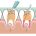 Milk tooth pulpotomy  پالپوتومی دندان چیست؟ root canal 36x36