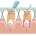 Milk tooth pulpotomy  پالپوتومی دندان چیست؟ root canal 36x36