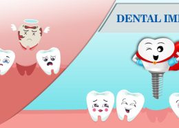 Advantages of dental implants [object object] مراقبت های پس از درمان ریشه Benefits of Dental Implants 260x185  مطالب دندانپزشکی Benefits of Dental Implants 260x185