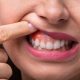 Prevention of gingivitis/دندانپزشکی در شیراز  ایمپلنت چگونه زندگی شما را تغییر میدهد؟ Gingival analysis 80x80