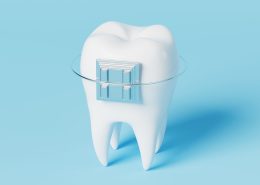 [object object] مراقبت های پس از درمان ریشه Single tooth 260x185  مطالب دندانپزشکی Single tooth 260x185