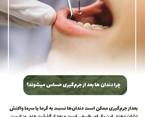 پیش‌نویس خودکار 8 نکته کلیدی مراقبت از دندان                                                     20240526 155940 0000 495x400