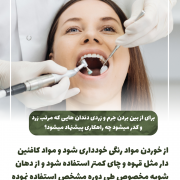 از بین بردن زردی دندان                                                     20240526 160427 0000 180x180