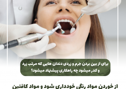 [object object] مراقبت های پس از درمان ریشه                                                     20240526 160427 0000 260x185  مطالب دندانپزشکی  D8 A7 D9 87 D9 85 DB 8C D8 AA  DA 86 DA A9 D8 A7 D9 BE  D8 AF D9 86 D8 AF D8 A7 D9 86  D9 87 D8 A7  D8 AF D8 B1  DA 86 DB 8C D8 B3 D8 AA D8 9F 20240526 160427 0000 260x185
