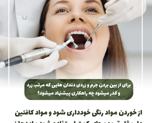 پیش‌نویس خودکار 8 نکته کلیدی مراقبت از دندان                                                     20240526 160427 0000 495x400