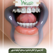 پیش‌نویس خودکار از مسواک مناسب استفاده کنید                                           20240608 095148 0000 e1721808592226 180x180