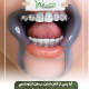 پیش‌نویس خودکار ایمپلنت برای افراد مسن                                           20240608 095148 0000 e1721808592226 80x80