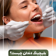 بلیچینگ دندان پیش‌نویس خودکار آیا دندان شیری خراب را باید کشید؟ IMG 20240616 103332 261 e1718523737935 180x180