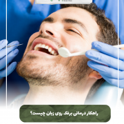 درمان برفک روی زبان پیش‌نویس خودکار آیا دندان شیری خراب را باید کشید؟ IMG 20240616 103332 758 e1718522951178 180x180