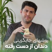 پیش‌نویس خودکار دندوناتم مثل پوستت ضدافتاب می خوان! cover 1 arasteh 180x180