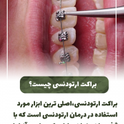 پیش‌نویس خودکار پوسیدگی دندان                                                     20240619 130917 0000 180x180
