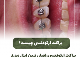 [object object] مراقبت های پس از درمان ریشه                                                     20240619 130917 0000 260x185  مطالب دندانپزشکی  D8 A7 D9 87 D9 85 DB 8C D8 AA  DA 86 DA A9 D8 A7 D9 BE  D8 AF D9 86 D8 AF D8 A7 D9 86  D9 87 D8 A7  D8 AF D8 B1  DA 86 DB 8C D8 B3 D8 AA D8 9F 20240619 130917 0000 260x185