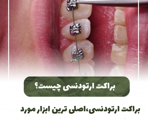 پیش‌نویس خودکار علت بوی بد دهان                                                     20240619 130917 0000 495x400
