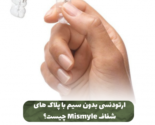 پیش‌نویس خودکار کامپوزیت دندان                                                     20240525 120302 0000 495x400