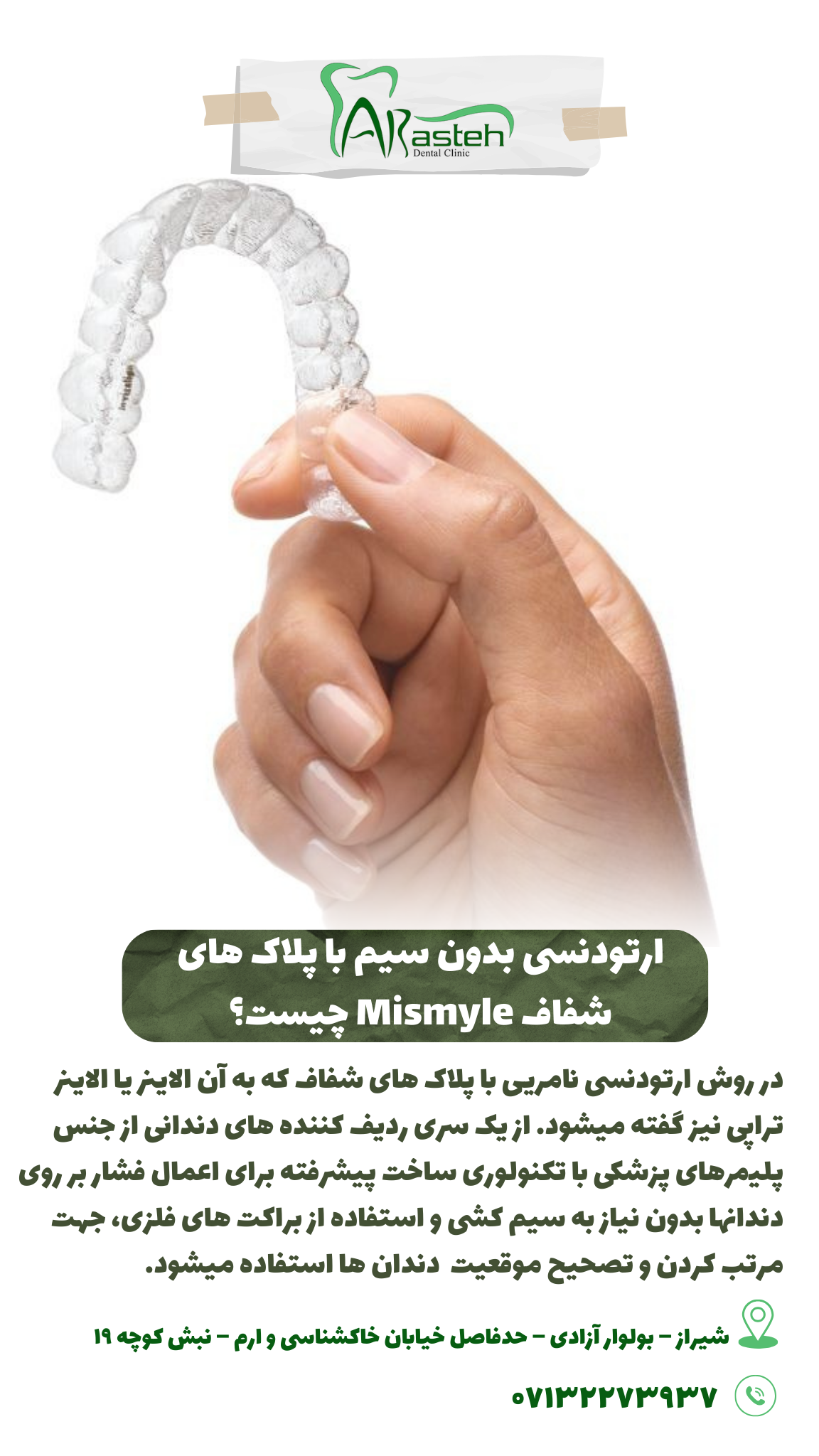 پیش‌نویس خودکار ارتودنسی با پلاک شفاف                                                     20240525 120302 0000