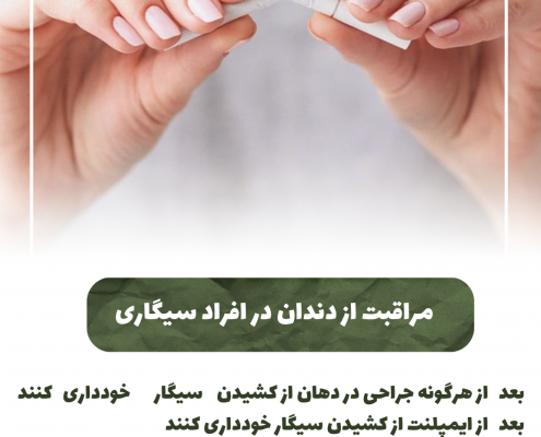 پیش‌نویس خودکار کامپوزیت دندان                                                     20240525 123502 0000 495x400