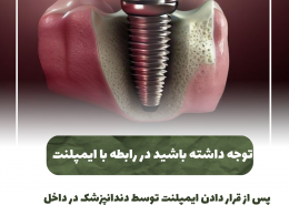 [object object] مراقبت های پس از درمان ریشه                                                     20240526 085934 0000 260x185  مطالب دندانپزشکی  D8 A7 D9 87 D9 85 DB 8C D8 AA  DA 86 DA A9 D8 A7 D9 BE  D8 AF D9 86 D8 AF D8 A7 D9 86  D9 87 D8 A7  D8 AF D8 B1  DA 86 DB 8C D8 B3 D8 AA D8 9F 20240526 085934 0000 260x185