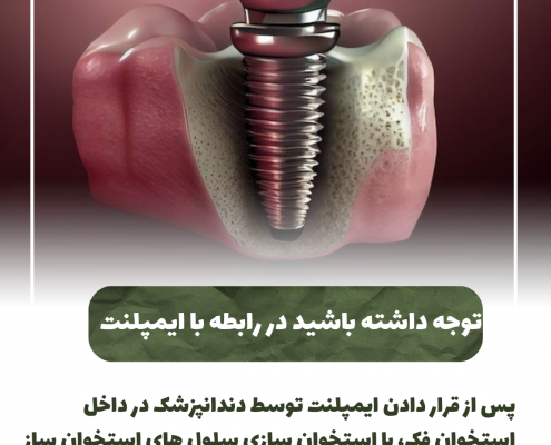پیش‌نویس خودکار کامپوزیت دندان                                                     20240526 085934 0000 495x400