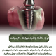 پیش‌نویس خودکار مراقبت از دندان در افراد سیگاری                                                     20240526 085934 0000 80x80
