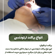 پیش‌نویس خودکار دندان درد مداوم و تیر کشیدن دندان                                                     20240625 125039 0000 180x180
