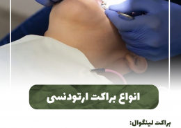 [object object] مراقبت های پس از درمان ریشه                                                     20240625 125039 0000 260x185  مطالب دندانپزشکی  D8 A7 D9 87 D9 85 DB 8C D8 AA  DA 86 DA A9 D8 A7 D9 BE  D8 AF D9 86 D8 AF D8 A7 D9 86  D9 87 D8 A7  D8 AF D8 B1  DA 86 DB 8C D8 B3 D8 AA D8 9F 20240625 125039 0000 260x185