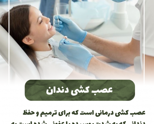 پیش‌نویس خودکار پری کرونیت چیست؟                                                     20240626 005837 0000 495x400