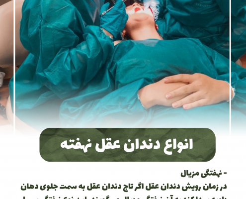 پیش‌نویس خودکار انواع دندان عقل نهفته                                                     20240701 133731 0000 495x400