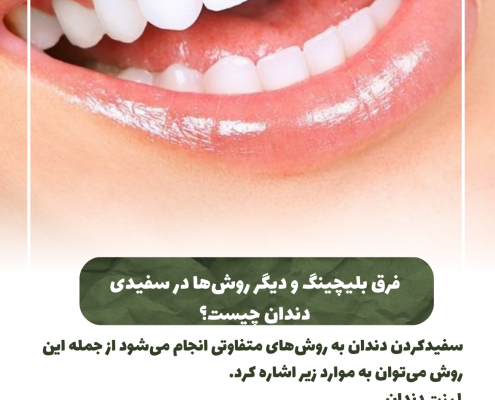 پیش‌نویس خودکار انواع دندان عقل نهفته                                                     20240703 152750 0000 495x400