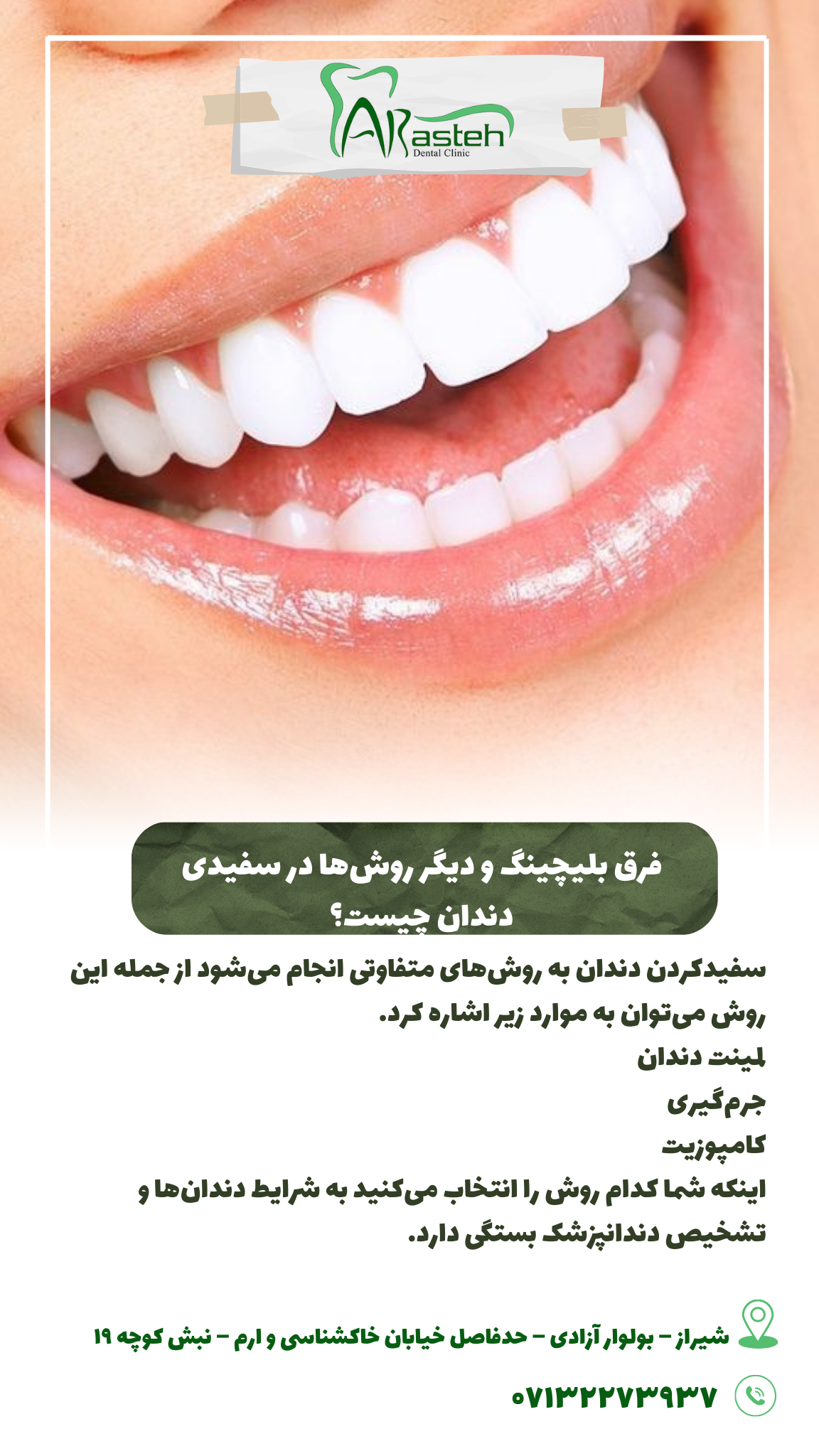 پیش‌نویس خودکار فرق بلیچینگ و دیگر روش ها در سفیدی دندان چیست؟                                                     20240703 152750 0000