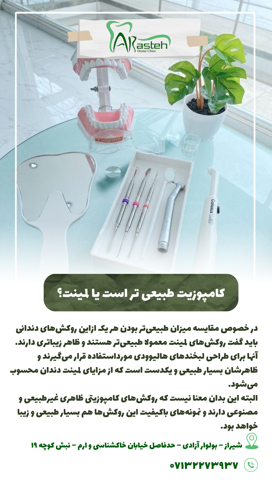 پیش‌نویس خودکار کامپوزیت طبیعی تر است یا لمینت؟                                                     20240707 161717 0000