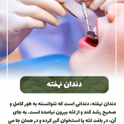 پیش‌نویس خودکار آیا دندان شیری خراب را باید کشید؟                                                     20240712 111326 0000 180x180
