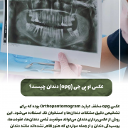 پیش‌نویس خودکار کمبود کدام ویتامین باعث پوسیدگی دندان می شود؟                                                     20240714 192722 0000 180x180
