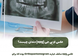 [object object] مراقبت های پس از درمان ریشه                                                     20240714 192722 0000 260x185  مطالب دندانپزشکی  D8 A7 D9 87 D9 85 DB 8C D8 AA  DA 86 DA A9 D8 A7 D9 BE  D8 AF D9 86 D8 AF D8 A7 D9 86  D9 87 D8 A7  D8 AF D8 B1  DA 86 DB 8C D8 B3 D8 AA D8 9F 20240714 192722 0000 260x185