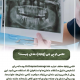 پیش‌نویس خودکار علایم عفونت پالپ دندان                                                     20240714 192722 0000 80x80