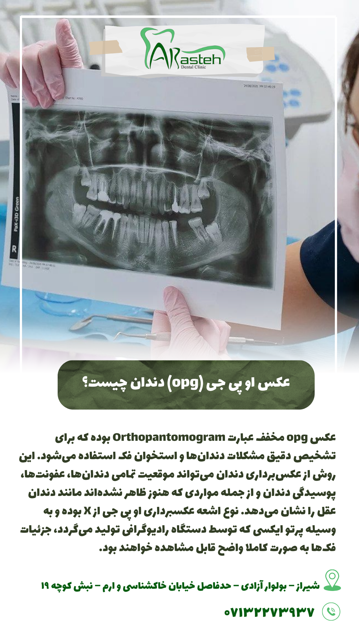 پیش‌نویس خودکار عکس او پی جی چیست؟                                                     20240714 192722 0000