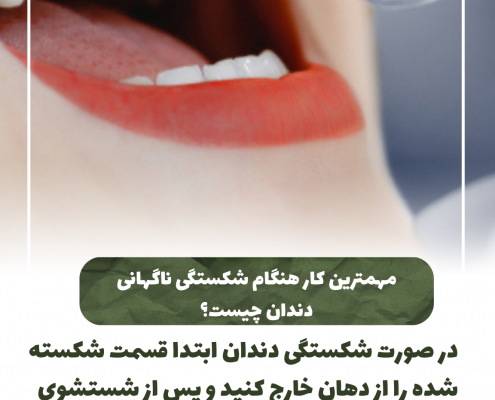 پیش‌نویس خودکار پری کرونیت چیست؟                                                     20240722 132052 0000 495x400