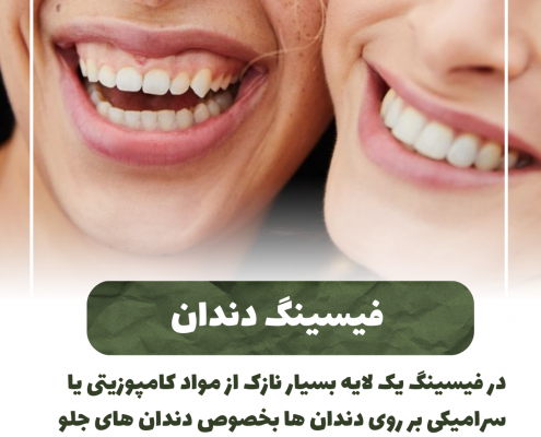 پیش‌نویس خودکار پری کرونیت چیست؟                                                     20240730 122544 0000 495x400