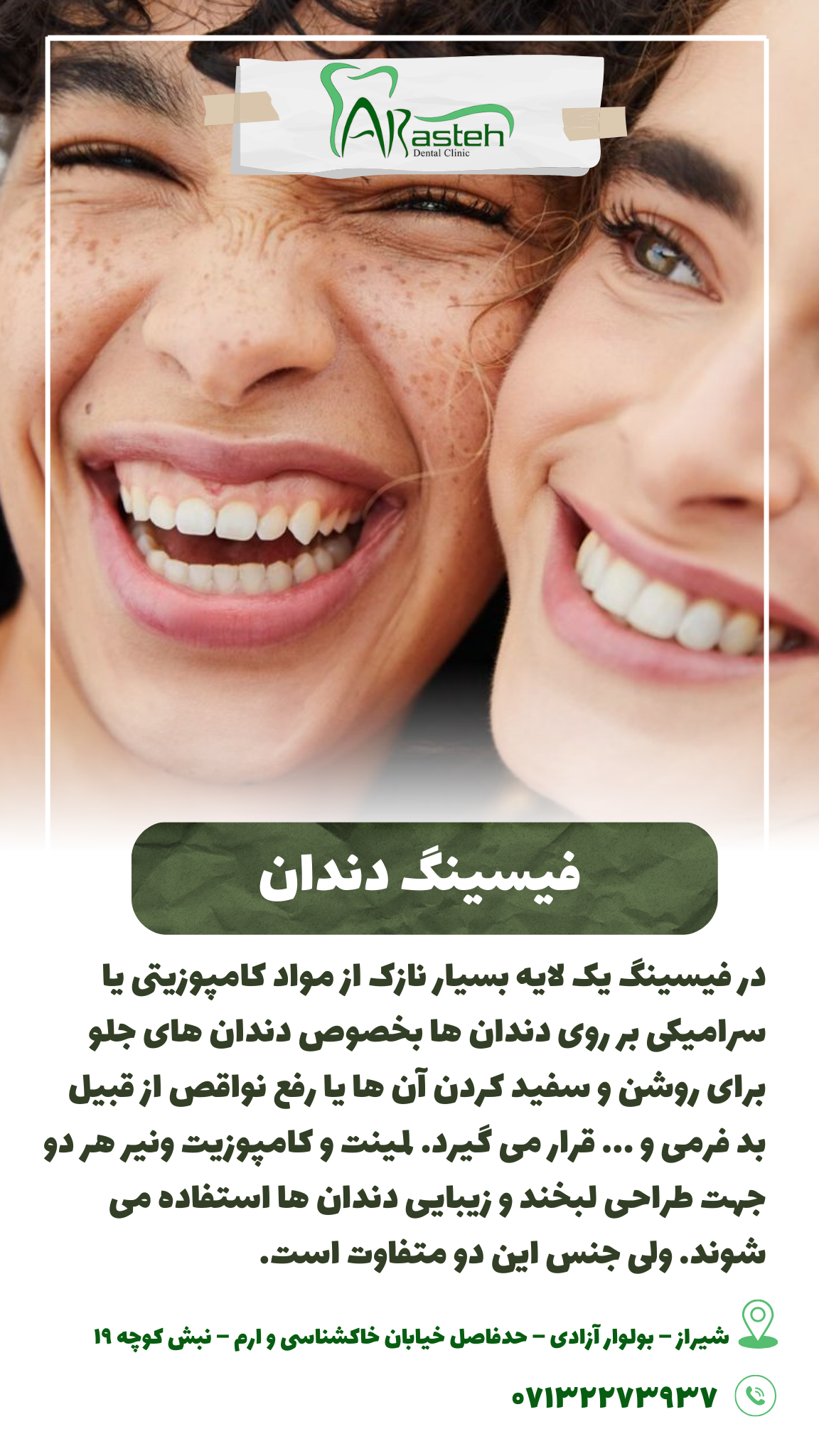 پیش‌نویس خودکار فیسینگ دندان                                                     20240730 122544 0000