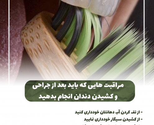 پیش‌نویس خودکار پری کرونیت چیست؟                                                     20240803 130907 0000 495x400