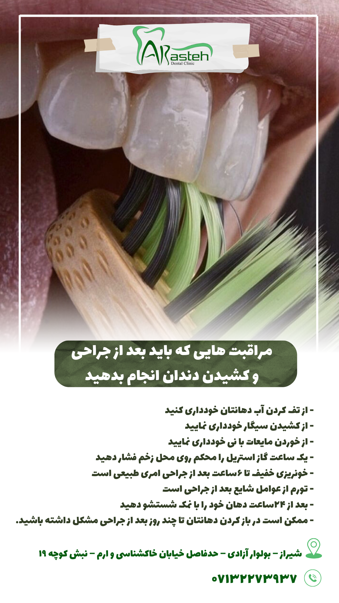 پیش‌نویس خودکار مراقبت های بعد ار کشیدن دندان                                                     20240803 130907 0000