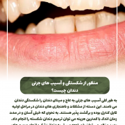 پیش‌نویس خودکار دندوناتم مثل پوستت ضدافتاب می خوان!                                                     20240806 133041 0000 180x180