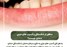 [object object] مراقبت های پس از درمان ریشه                                                     20240806 133041 0000 260x185  مطالب دندانپزشکی  D8 A7 D9 87 D9 85 DB 8C D8 AA  DA 86 DA A9 D8 A7 D9 BE  D8 AF D9 86 D8 AF D8 A7 D9 86  D9 87 D8 A7  D8 AF D8 B1  DA 86 DB 8C D8 B3 D8 AA D8 9F 20240806 133041 0000 260x185